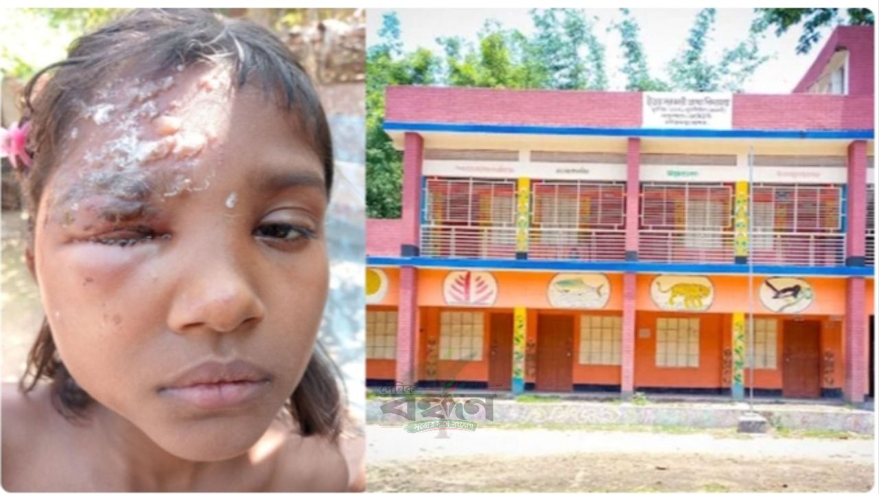 মনিরামপুরে শিক্ষার্থীদের চাঁদায় শিক্ষক দিবস, পার্টি স্প্রেতে ছাত্রীর চোখ ক্ষতিগ্রস্ত