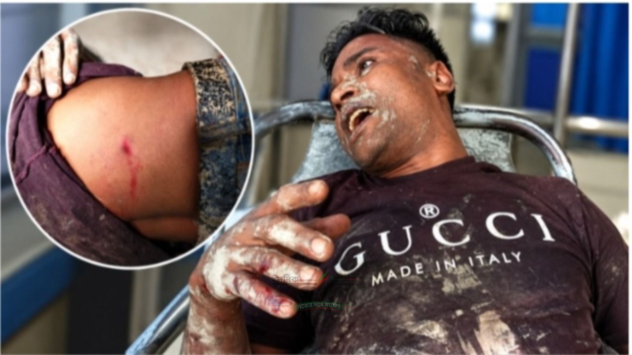 যশোরে চাঁদা তোলা নিয়ে বিরোধ, যুবককে কুপিয়ে জখমের অভিযোগ