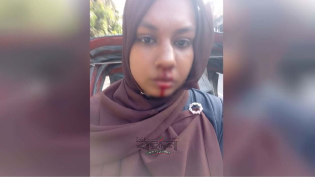 যশোরে ছেলেকে মারধরের প্রতিবাদ করায় মায়ের মুখে ইট দিয়ে আঘাতের অভিযোগ